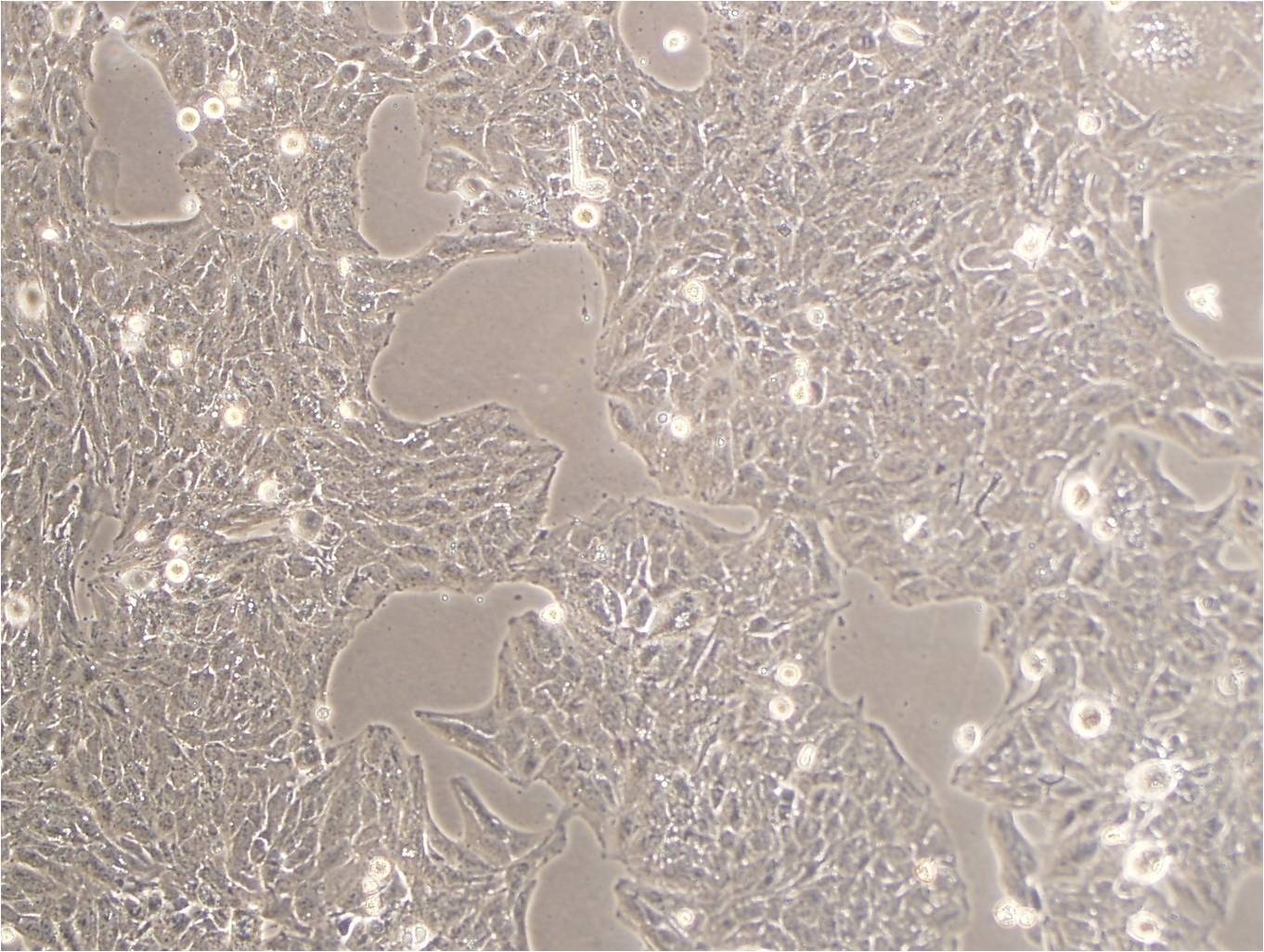 NCI-H1436:人小细胞肺癌复苏细胞(提供STR鉴定图谱),NCI-H1436