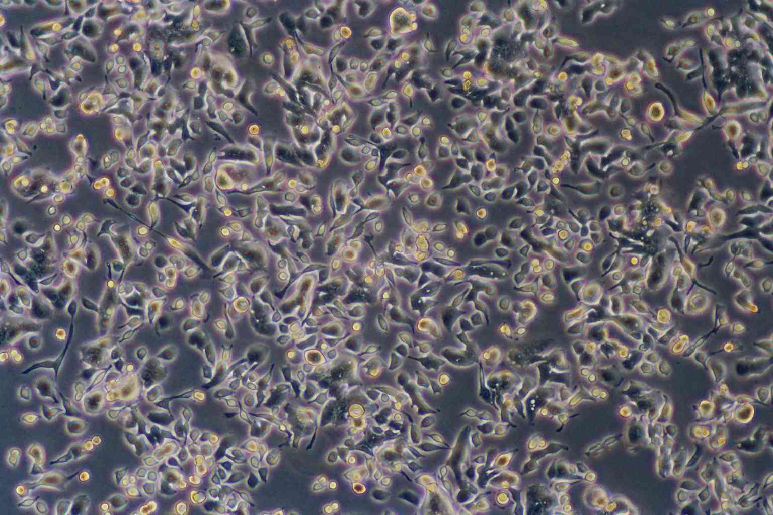 NCI-H647:人非小细胞肺癌复苏细胞(提供STR鉴定图谱),NCI-H647