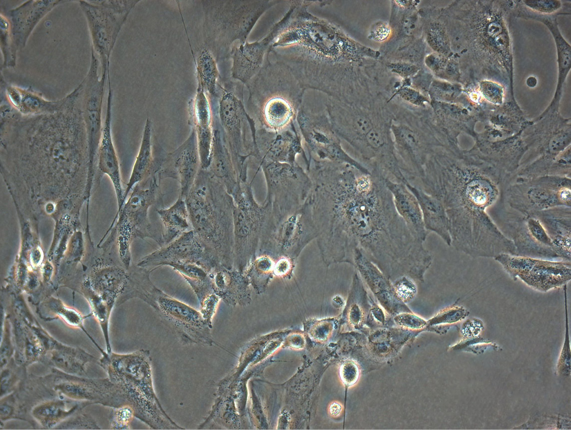 HCC1937:人乳腺癌复苏细胞(提供STR鉴定图谱),HCC1937