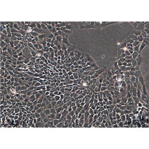 MKN45:人胃癌复苏细胞(提供STR鉴定图谱)
