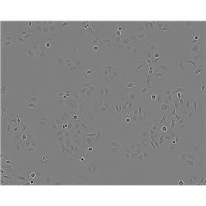 HO-1-N-1:人鳞状上皮细胞癌复苏细胞(提供STR鉴定图谱)