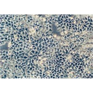 SNU-16:人胃癌复苏细胞(提供STR鉴定图谱)