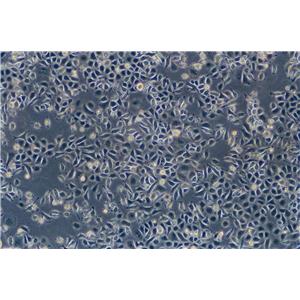 COV434:人卵巢颗粒肿瘤复苏细胞(提供STR鉴定图谱)