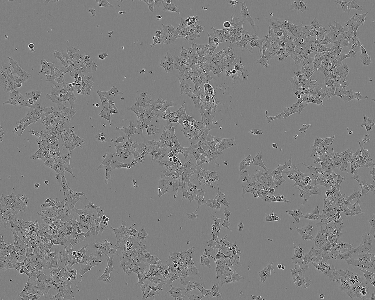 NMC-G1:人脑胶质复苏细胞(提供STR鉴定图谱),NMC-G1