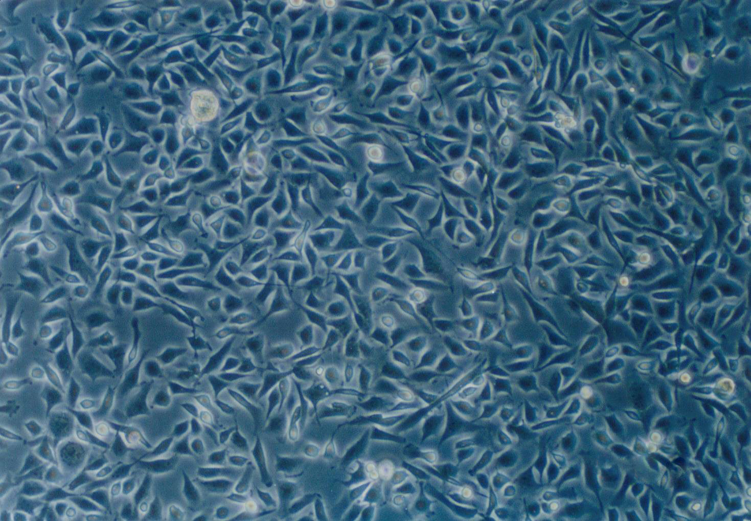 HBZY-1:大鼠肾小球系膜复苏细胞(提供STR鉴定图谱),HBZY-1