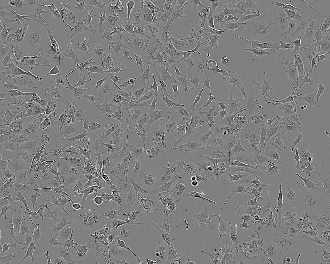 RGC-5:小鼠视网膜神经节复苏细胞(提供STR鉴定图谱),RGC-5