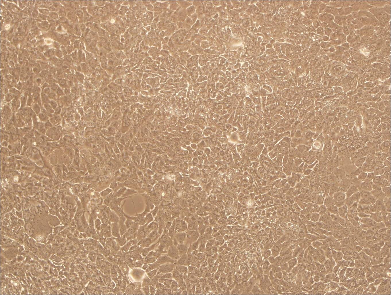 Ishikawa:人子宫内膜癌复苏细胞(提供STR鉴定图谱),Ishikawa