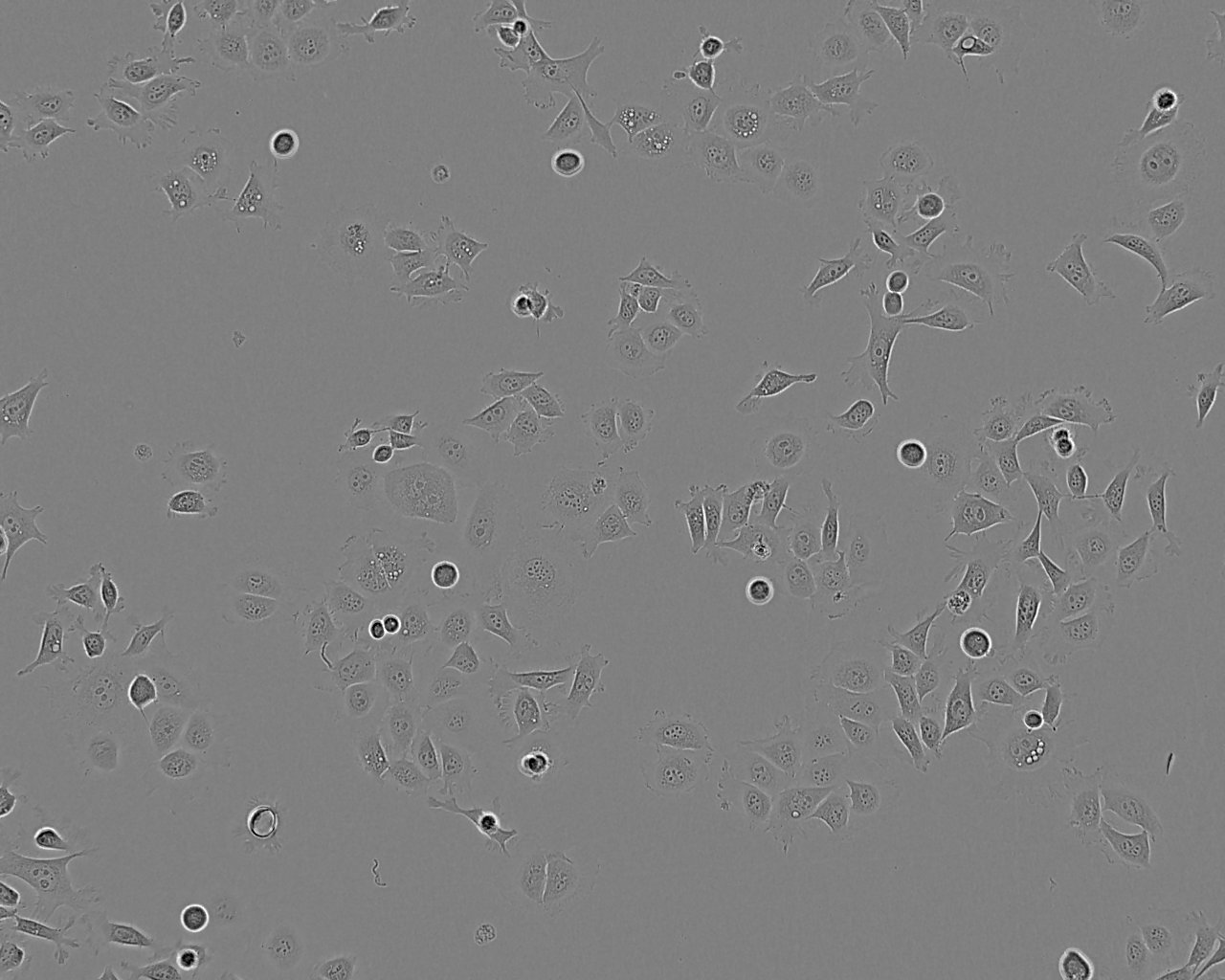 WEHI-279 Cells(赠送Str鉴定报告)|小鼠淋巴瘤细胞,WEHI-279 Cells