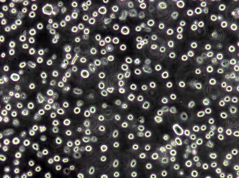 KHYG-1 Cells(赠送Str鉴定报告)|人NK细胞淋巴瘤细胞,KHYG-1 Cells