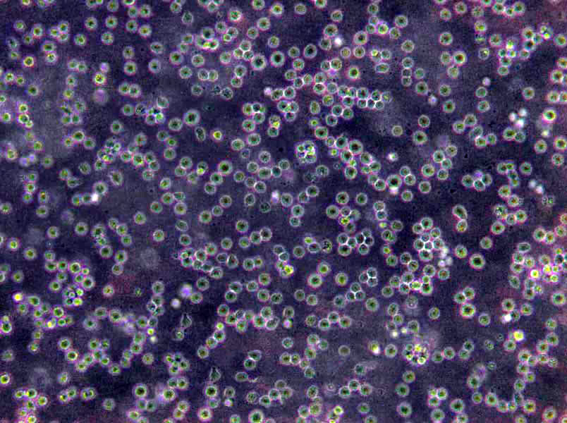 CEMO-1 Cells(赠送Str鉴定报告)|人急性B淋巴细胞白血病细胞,CEMO-1 Cells