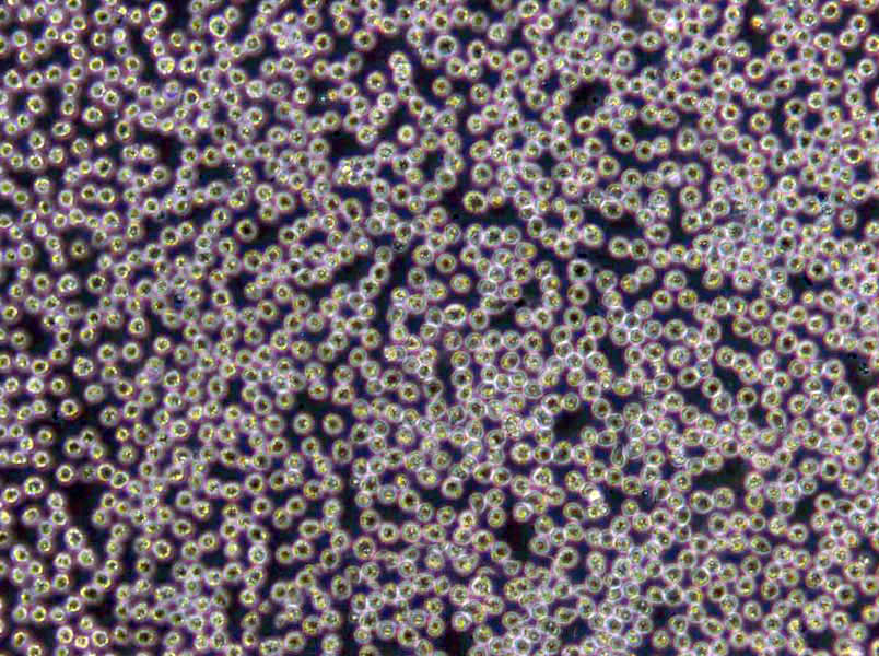 CII Cells(赠送Str鉴定报告)|人慢性淋巴细胞白血病细胞,CII Cells