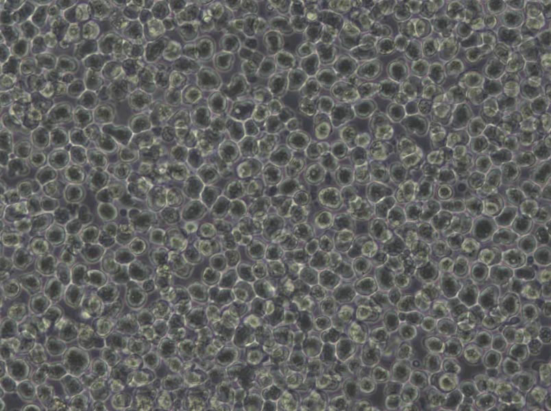 L-428 Cells(赠送Str鉴定报告)|人霍奇金淋巴瘤细胞,L-428 Cells