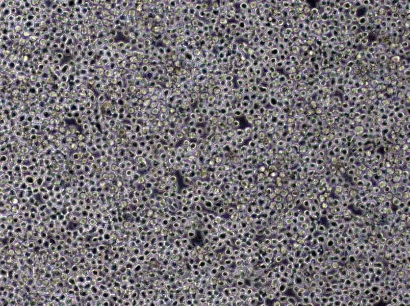 Nb2-11 Cells(赠送Str鉴定报告)|大鼠淋巴瘤细胞,Nb2-11 Cells