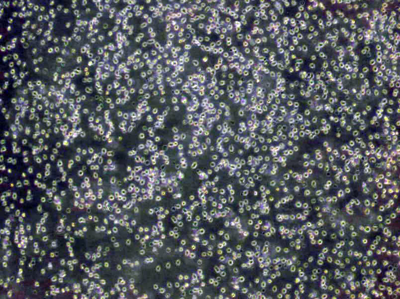 1301 Cells(赠送Str鉴定报告)|人急性T淋巴细胞白血病细胞,1301 Cells