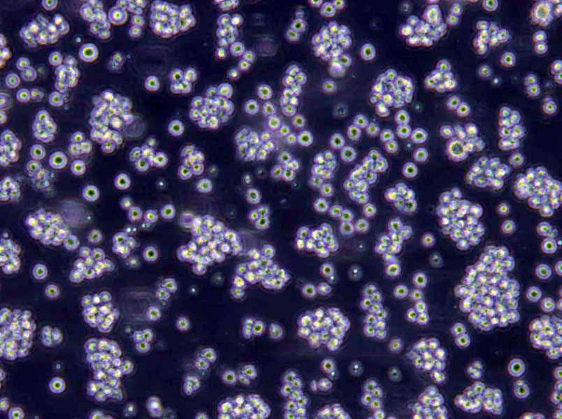 SU-DHL-2 Cells(赠送Str鉴定报告)|人弥漫性大细胞淋巴瘤细胞,SU-DHL-2 Cells