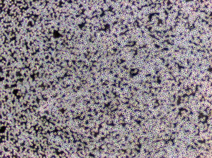 WEHI-3B Cells(赠送Str鉴定报告)|小鼠髓样单核白血病细胞,WEHI-3B Cells