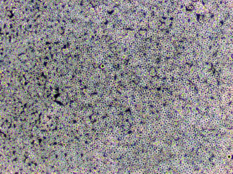 C1498 Cells(赠送Str鉴定报告)|小鼠白血病细胞,C1498 Cells