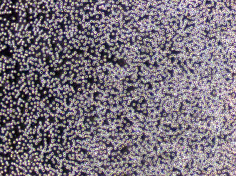 CCRF-SB Cells(赠送Str鉴定报告)|人急性T淋巴细胞白血病细胞,CCRF-SB Cells