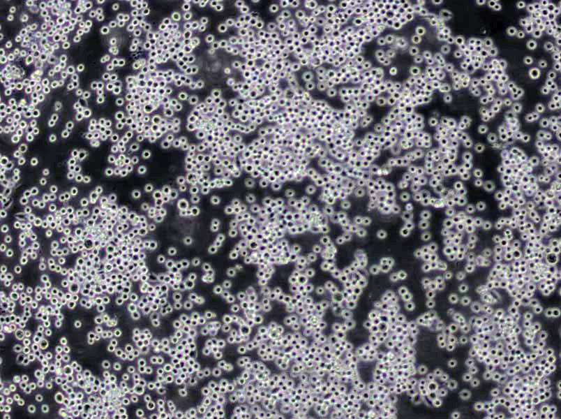 NK-92MI Cells(赠送Str鉴定报告)|人恶性非霍奇金淋巴瘤患者NK细胞,NK-92MI Cells