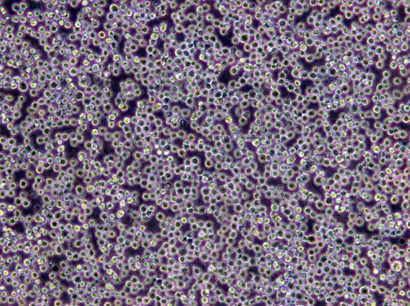 MDCC-MSB1 Cells(赠送Str鉴定报告)|鸡淋巴瘤细胞,MDCC-MSB1 Cells