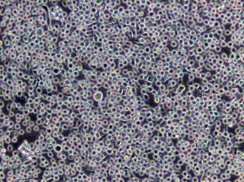 A20 Cells(赠送Str鉴定报告)|小鼠B细胞淋巴瘤细胞,A20 Cells