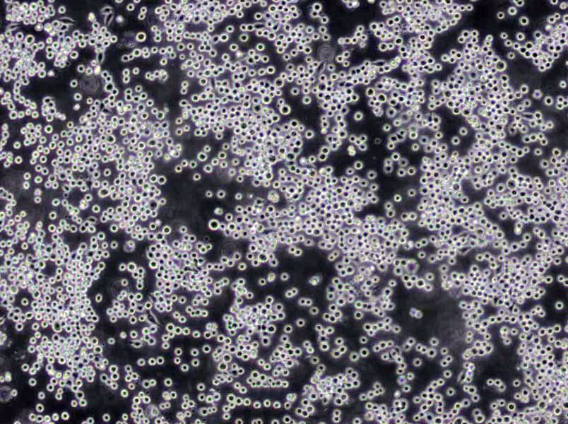 SNK-6 Cells(赠送Str鉴定报告)|人NK/T细胞淋巴瘤细胞,SNK-6 Cells
