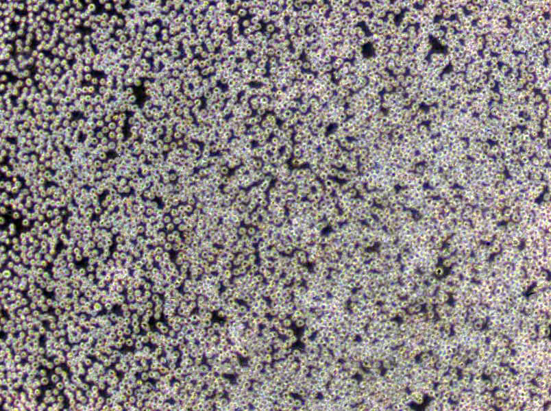 A3 Cells(赠送Str鉴定报告)|人T淋巴细胞白血病细胞,A3 Cells