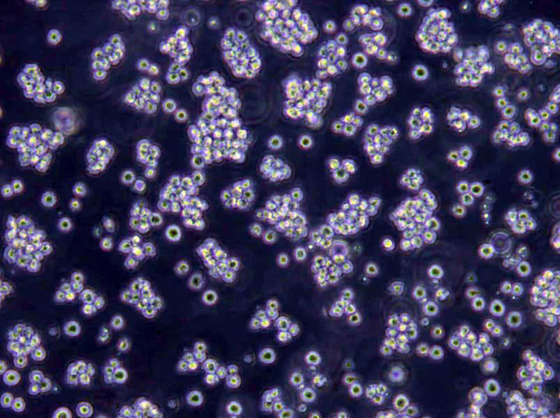 SU-DHL-10 Cells(赠送Str鉴定报告)|人B细胞淋巴瘤细胞,SU-DHL-10 Cells