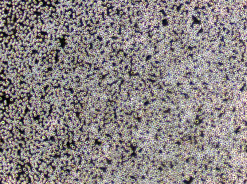 SU-DHL-4 Cells(赠送Str鉴定报告)|人弥漫性组织淋巴瘤细胞,SU-DHL-4 Cells