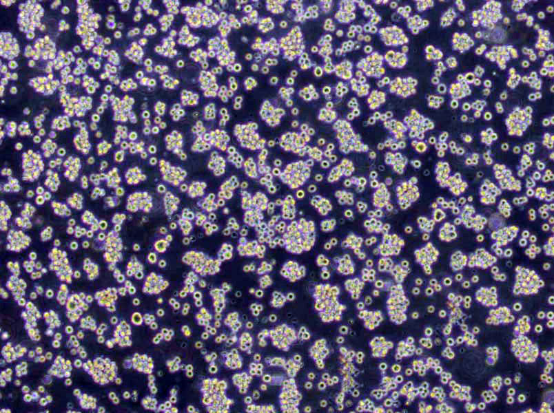 EB3 [Human Burkitt lymphoma] Cells(赠送Str鉴定报告)|人伯基特淋巴瘤细胞,EB3 [Human Burkitt lymphoma] Cells