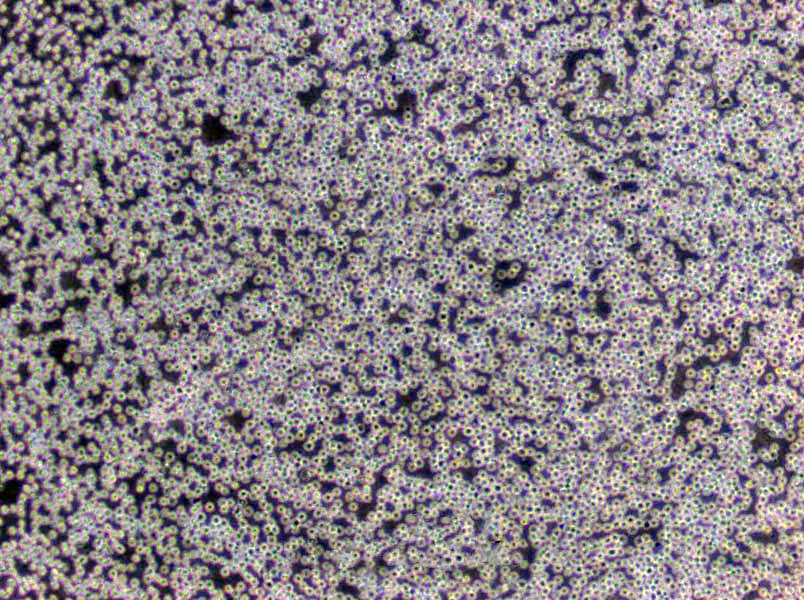 HL-60 Clone 15 Cells(贈送Str鑒定報告)|人急性早幼粒細胞白血病細胞,HL-60 Clone 15 Cells