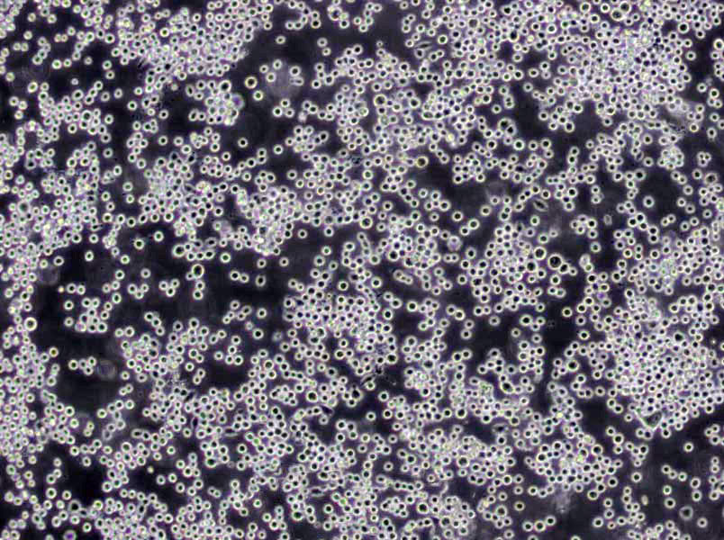 U266B1 Cells(赠送Str鉴定报告)|人外周淋巴细胞,U266B1 Cell