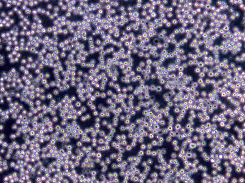 HuT 102 Cells(赠送Str鉴定报告)|人T淋巴瘤细胞,HuT 102 Cells