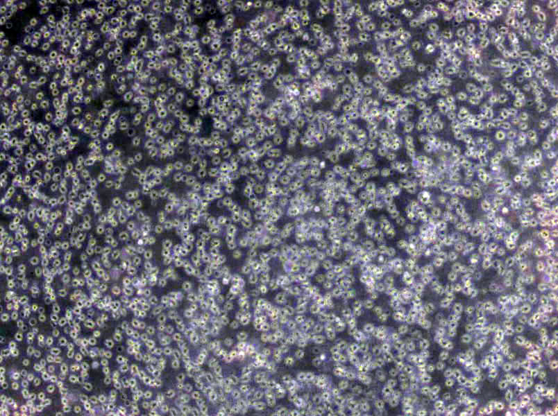 EB2 Cells(赠送Str鉴定报告)|人B淋巴细胞瘤细胞,EB2 Cells
