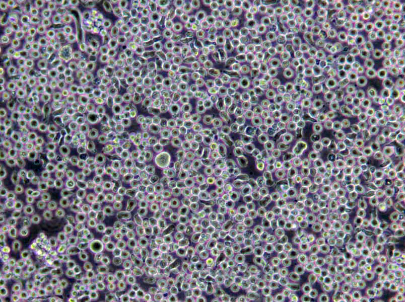 AML-193 Cells(赠送Str鉴定报告)|人急性单核细胞白血病单核细胞,AML-193 Cells