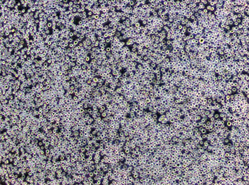 CTLL-2 Cells(赠送Str鉴定报告)|小鼠T淋巴细胞,CTLL-2 Cells