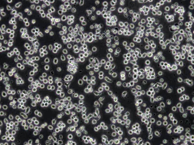 BALL-1 Cells(赠送Str鉴定报告)|人B淋巴细胞急性白血病细胞,BALL-1 Cells