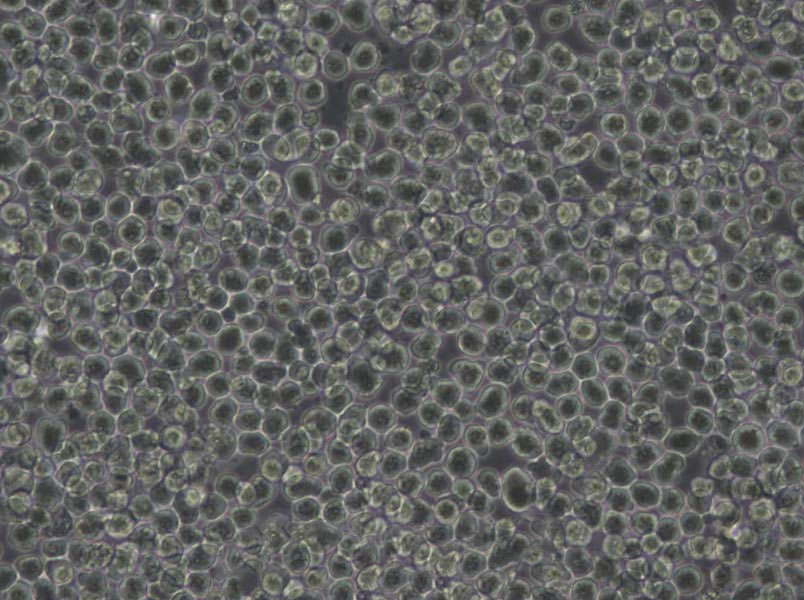 MT-4 Cells(赠送Str鉴定报告)|人急性淋巴母细胞白血病细胞,MT-4 Cells