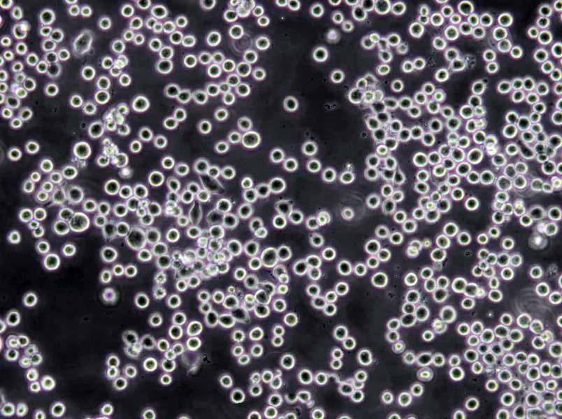 CCD-1112sk Cells(赠送Str鉴定报告)|人包皮成纤维细胞,CCD-1112sk Cells