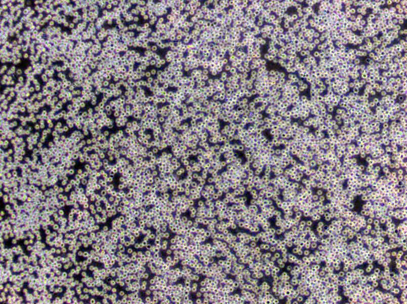 CCD-18Co Cells(赠送Str鉴定报告)|正常人结肠成纤维细胞,CCD-18Co Cells