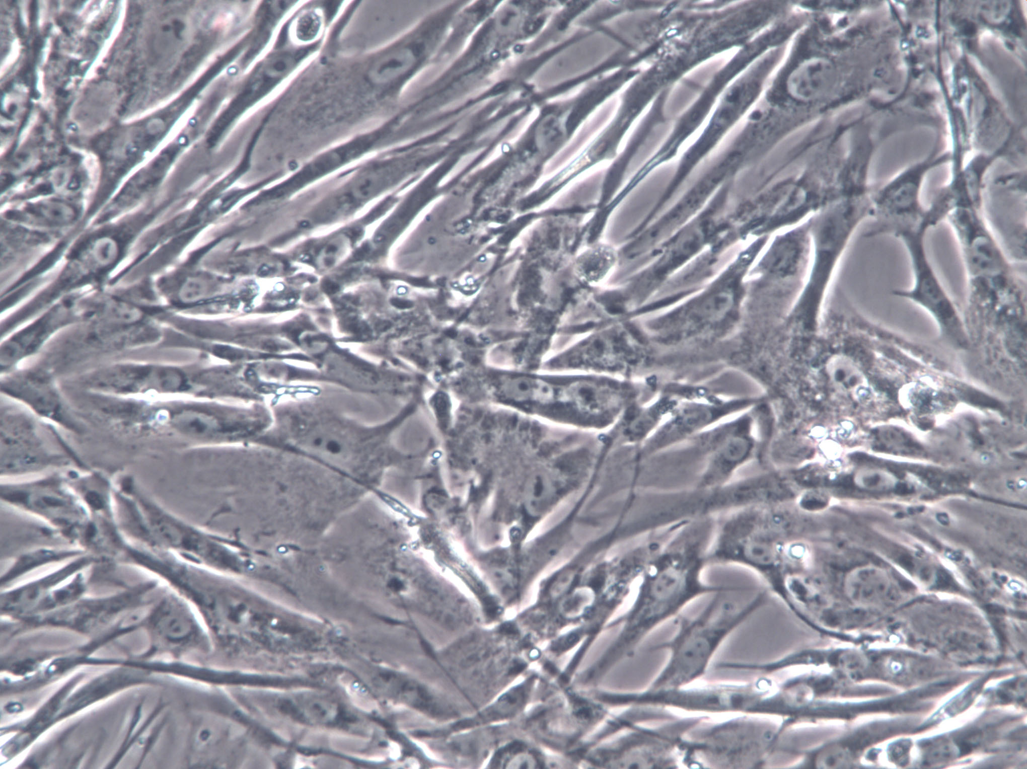 NRK-49F Cells(赠送Str鉴定报告)|大鼠正常肾成纤维细胞,NRK-49F Cells