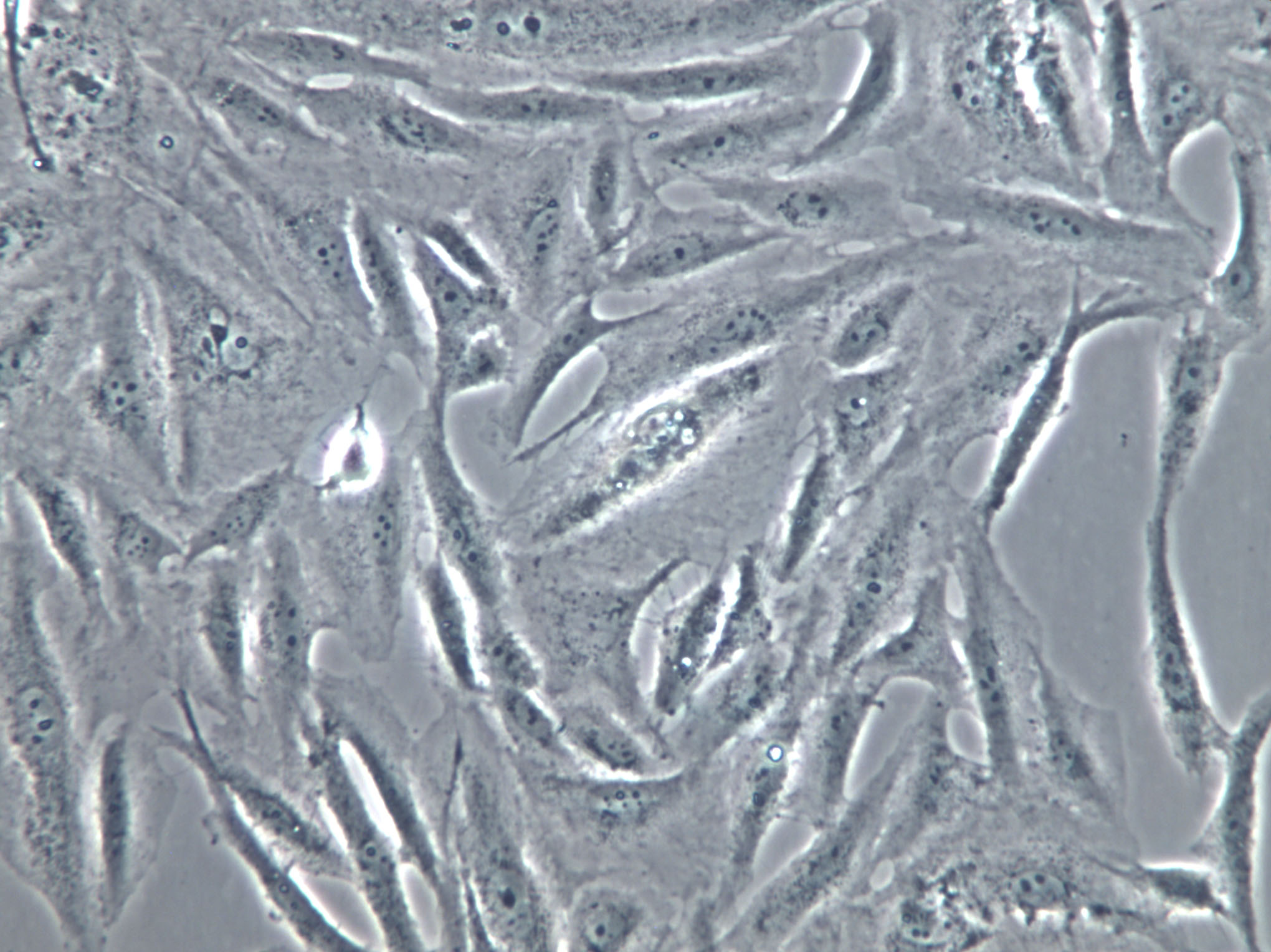 HFLS-RA Cells(赠送Str鉴定报告)|类风湿关节炎成纤维样滑膜细胞,HFLS-RA Cells(