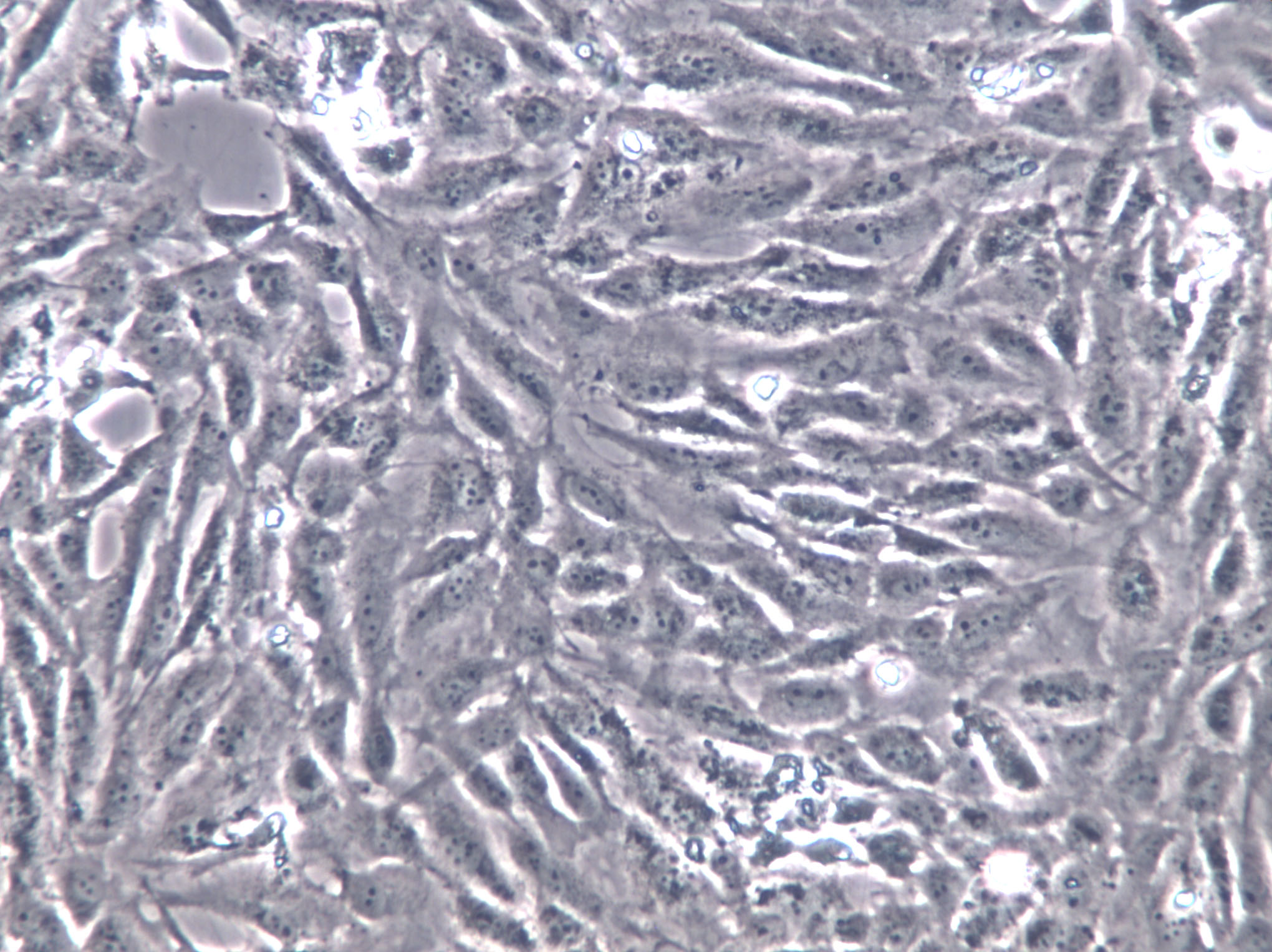 RA-FLSs Cells(赠送Str鉴定报告)|类风湿关节炎成纤维样滑膜细胞,RA-FLSs Cells