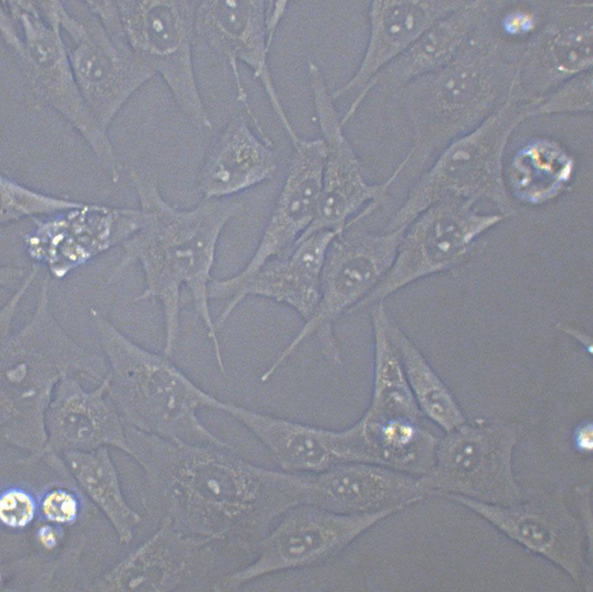 Psi2 DAP Cells(贈送Str鑒定報告)|小鼠胚胎成纖維細胞,Psi2 DAP Cells