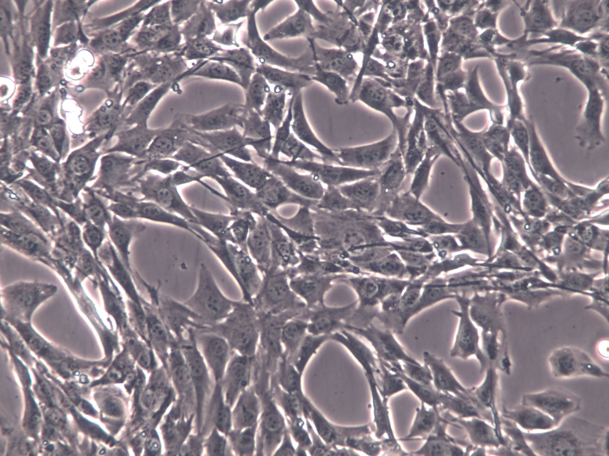 balb/3t3 clone a31 cells(贈送str鑑定報告)|小鼠胚胎成纖維細胞