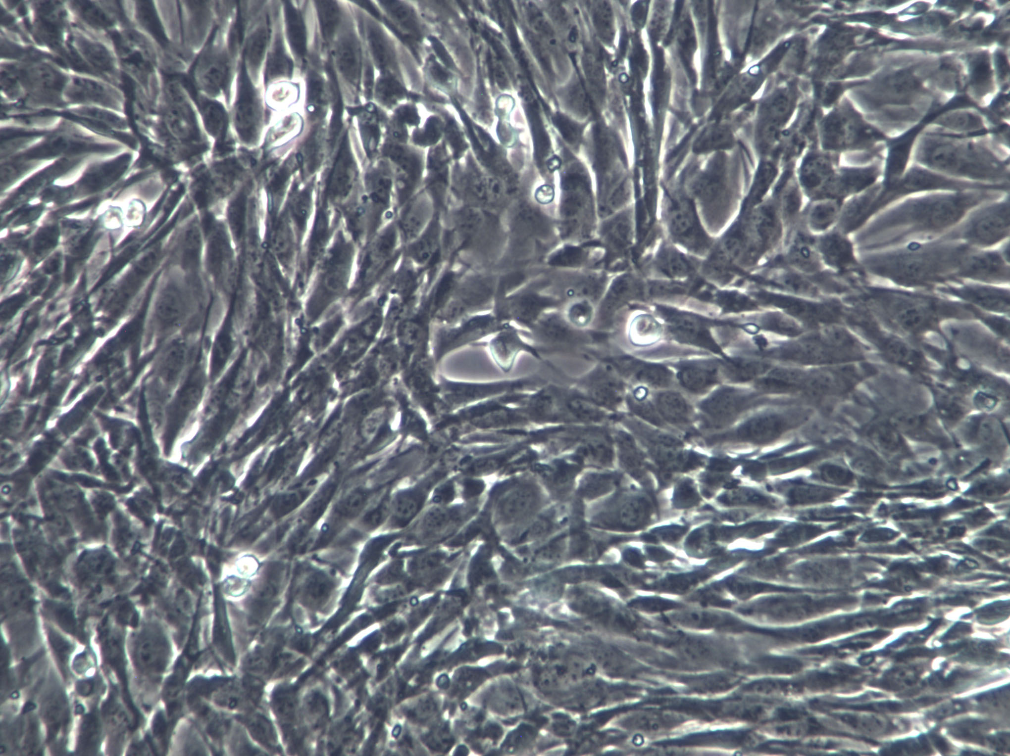 RS1 Cells(赠送Str鉴定报告)|大鼠皮肤成纤维样细胞,RS1 Cells