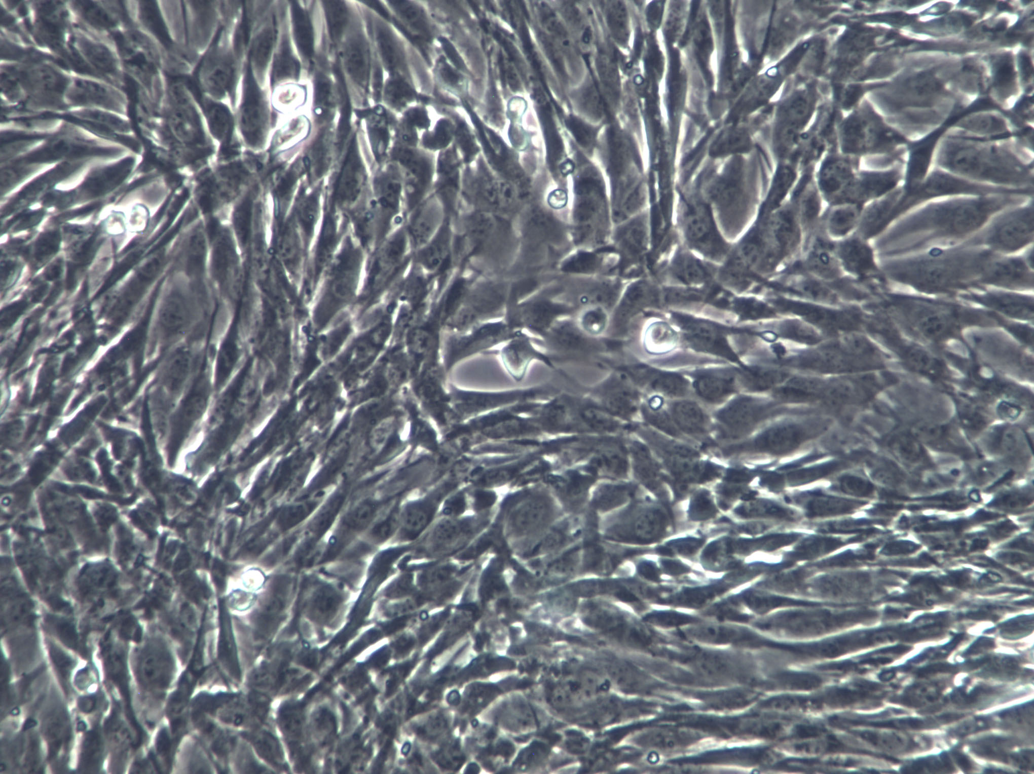 SK-LMS-1 Cells(赠送Str鉴定报告)|人阴户平滑肌肉瘤细胞,SK-LMS-1 Cells