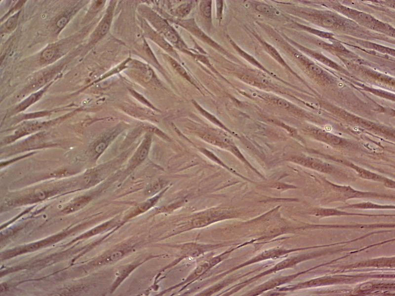 EJ-1 Cells(赠送Str鉴定报告)|人膀胱癌细胞,EJ-1 Cells
