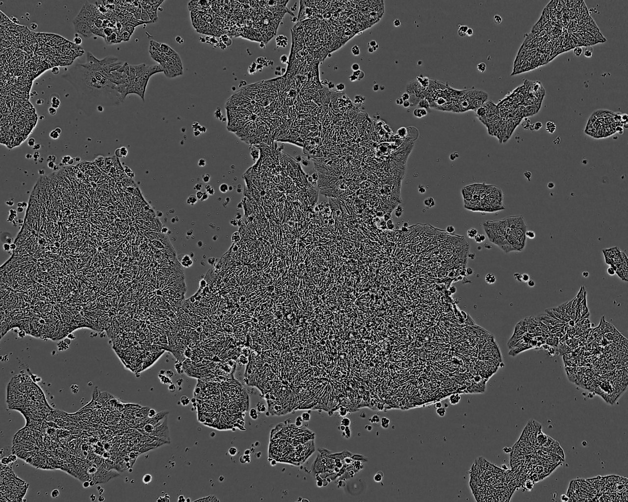 PC-10 Cells(赠送Str鉴定报告)|人肺鳞癌细胞,PC-10 Cells