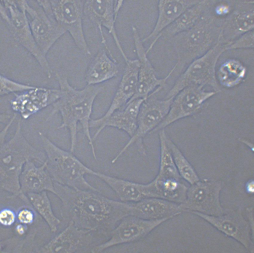 NE-1 Cells(赠送Str鉴定报告)|人永生化食管上皮细胞,NE-1 Cells